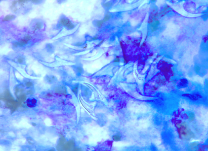EchinococcusCellNetix_F.jpg