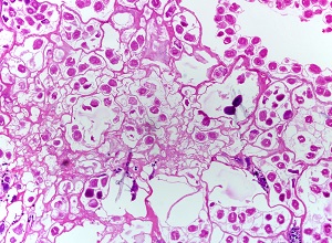 Em_cyst1 Figure C