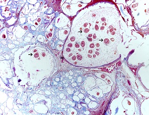 Em_cyst_tri Figure D