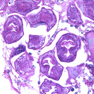 Emultilocularis_liver_BAM1.jpg Figure A