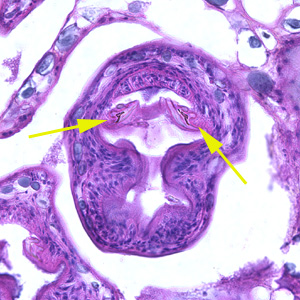 Emultilocularis_liver_BAM2.jpg