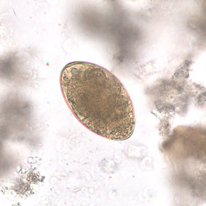 Echinostoma_egg_dog_BAM1.jpg Figure A