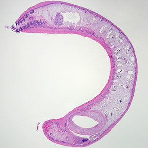 Echinostoma_tissue_BAM1.jpg