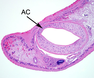 Echinostoma_tissue_BAM2.jpg