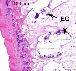 Echinostoma_tissue_BAM4.jpg Figure D