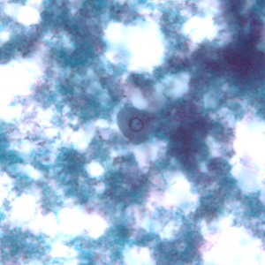 E_gingivalis_troph_BAM3.jpg Figure A