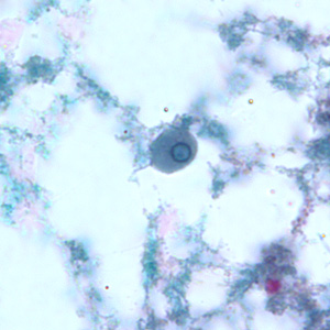 E_gingivalis_troph_BAM4.jpg Figure D