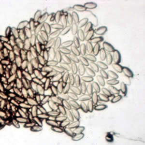 Evermicularis_worm4_HB.jpg