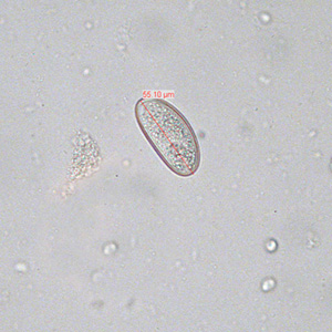 Evermicularis_SC_egg.jpg