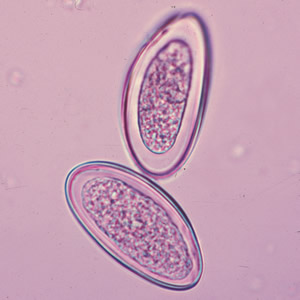 Evermicularis_egg_HBa.jpg
