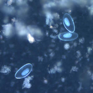 Evermicularis_egg_UVa.jpg