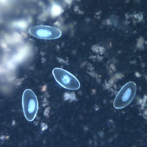 Evermicularis_egg_UVb.jpg