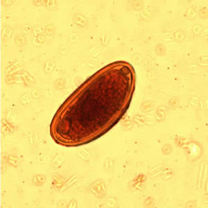 Evermicularis_egg_wtmt.jpg