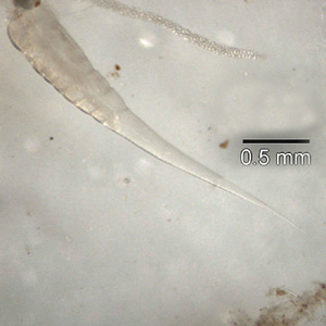 Evermicularis_SC_posterior.jpg Figure F