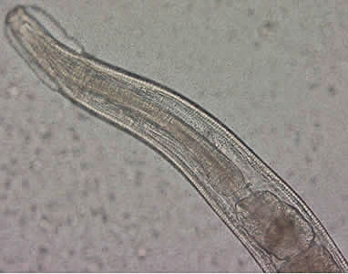 Evermicularis_adult_anterior_Norway.jpg