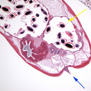 Evermicularis_Sheboygan_cross.jpg