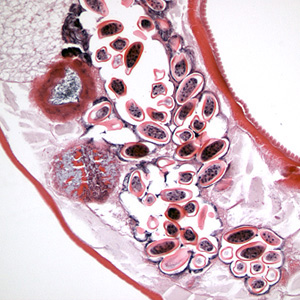 Evermicularis_Sheboygan_longitud.jpg