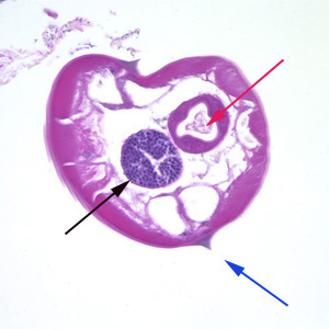 Evermicularis_worm4_HB.jpg