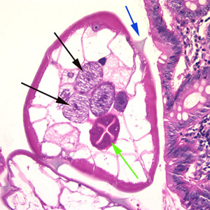 Evermicularis_worm5_HB.jpg