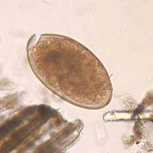 F_hepatica_egg_wtmt_HB1.jpg