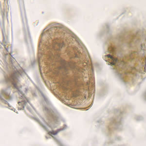 F_hepatica_egg_wtmt_HB2.jpg
