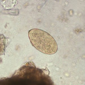 Fasciola_egg_2x2.jpg