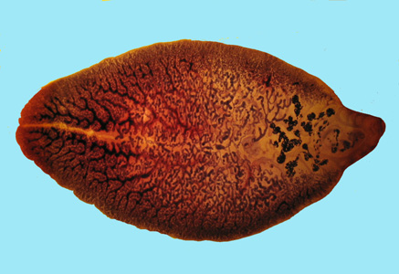 F_hepatica_adult_stained_BAM.jpg