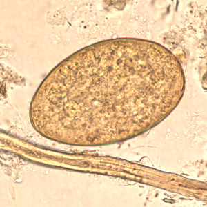 F_buski_egg_wtmt_BAM1.jpg