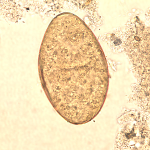 F_buski_egg_wtmt_BAM2.jpg