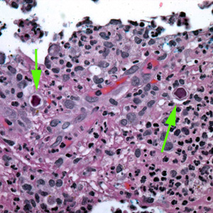 Acanthamoeba_HE_Vish2.jpg