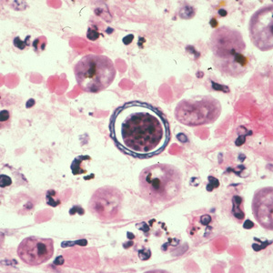 Acanthamoeba_HE_Vish3.jpg