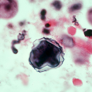 Acanthamoeba_HE_Vish4.jpg