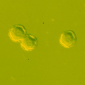 Acanthamoeba_cysts_culture_Vish1.jpg