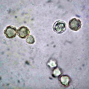 Acanthamoeba_cysts_culture_Vish2.jpg