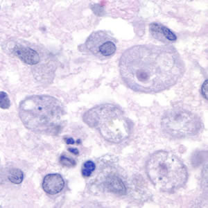 Acanthamoeba.jpg