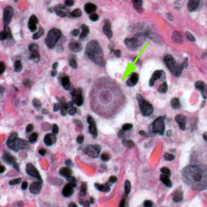 Acanthamoeba_HE_Vish1_1000x.jpg