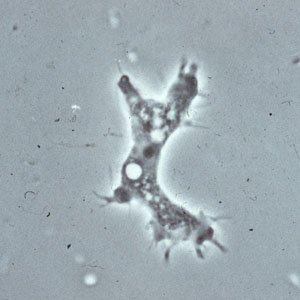 Acanthamoeba_troph_culture_Vish1.jpg