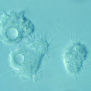Acanthamoeba_troph_culture_Vish2.jpg