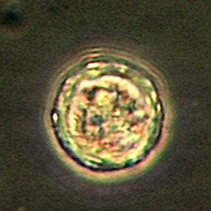 Balamuthia_cyst_Vish2.jpg