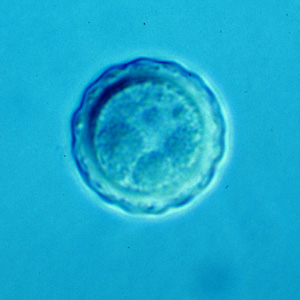 Balamuthia_cyst_Vish3.jpg