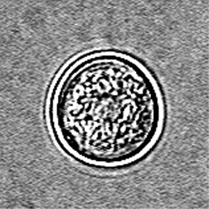 N_fowleri_cyst_Vish1.jpg
