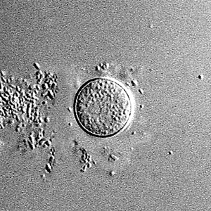 Sappinia_cyst_Vish1.jpg
