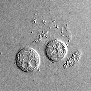 Sappinia_cyst_Vish2.jpg