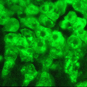 Acanthamoeba_IFA_Vish1_1000x.jpg
