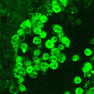 Acanthamoeba_IFA_Vish2_400x.jpg