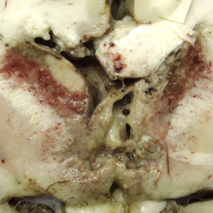 Brain_pathology_Cook1.jpg