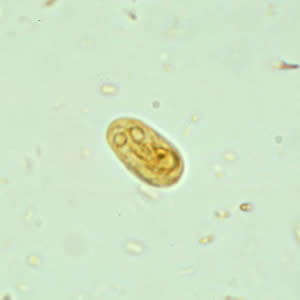 Giardia_cyst_wtmt.jpg