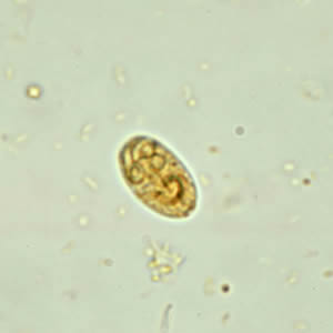 Giardia_cyst_wtmt2.jpg