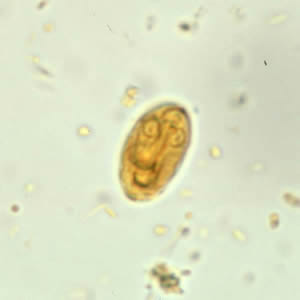 Giardia_cyst_wtmt3.jpg