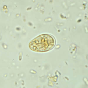 Giardia_cyst_wtmt4.jpg